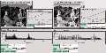 Histogram Equalization, B/W